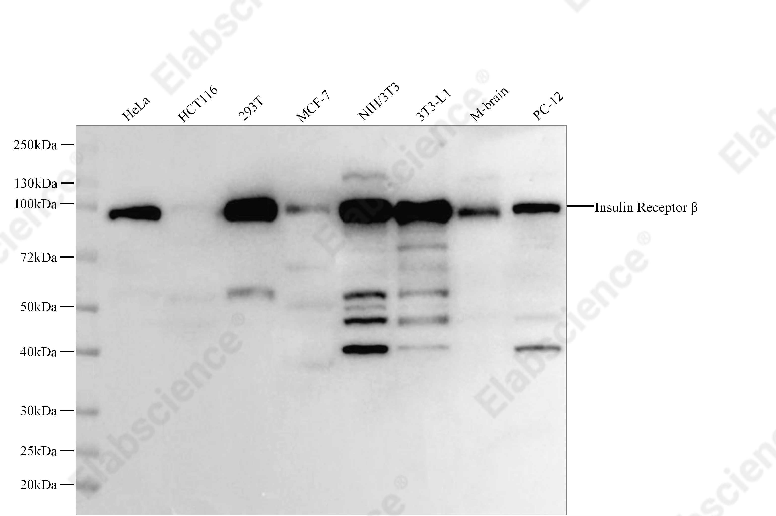 Recombinant Insulin Receptor β Monoclonal Antibody - 1
