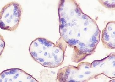 Recombinant 5T4 Monoclonal Antibody-searchlist-2