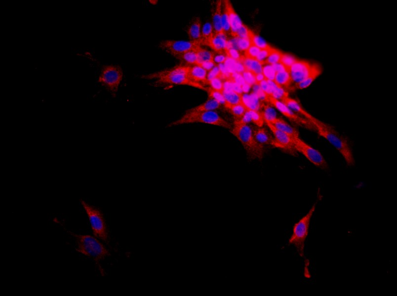 Mouse Intrahepatic Bile Duct Epithelial Cell Complete Medium - 2