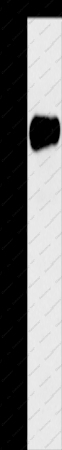 AMY2A Polyclonal Antibody - 1