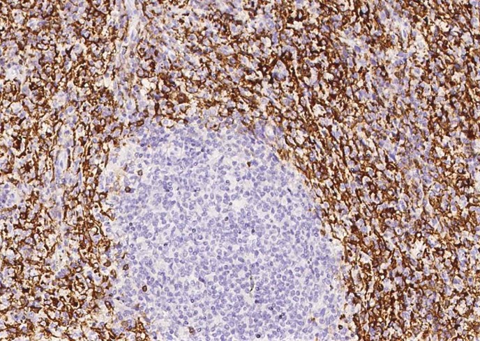 CD16b/FCGR3B Monoclonal Antibody - small - 2