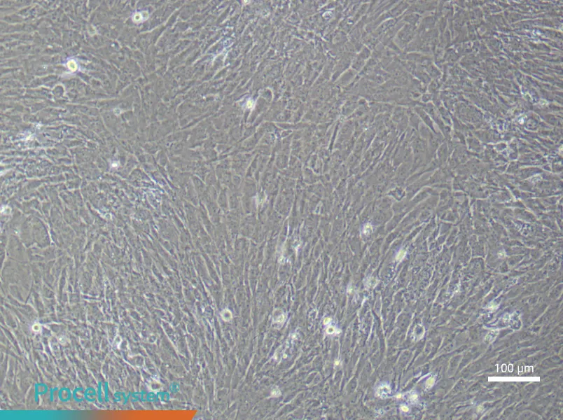 Human Mammary Cancer Fibroblast (Primary cell immortalization) Complete MediumHuman Mammary Cancer Fibroblast (Primary cell immortalization) Complete Medium - 2