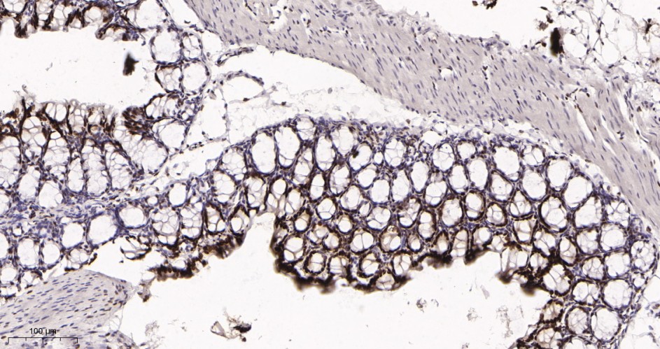 Recombinant KLF4 Monoclonal Antibody - small - 3