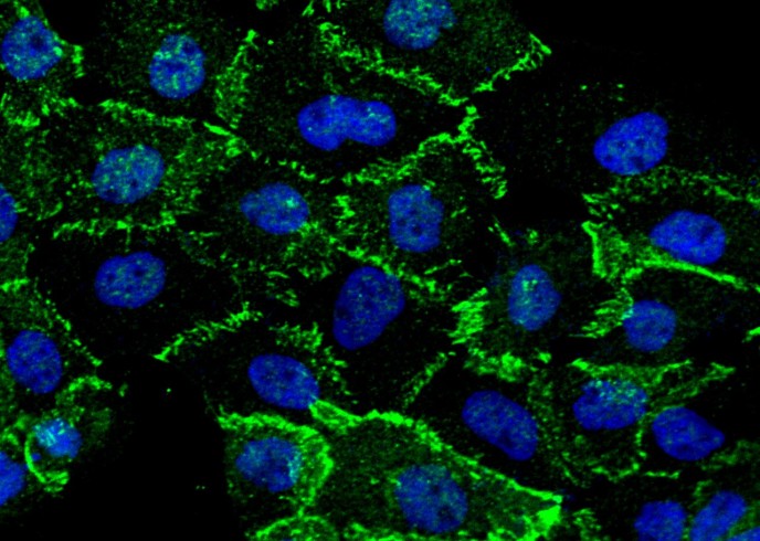Recombinant beta-Catenin/CTNNB1 Monoclonal Antibody-searchlist-1