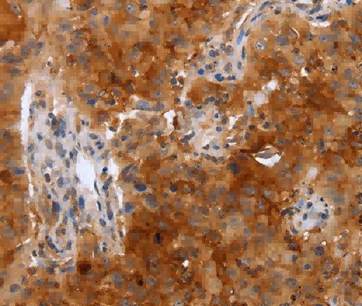PLAUR Polyclonal Antibody - 2