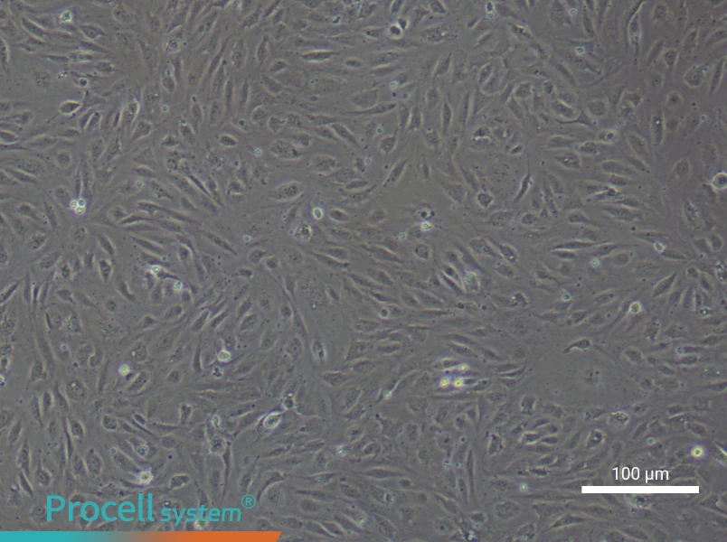 Human Pulmonary Arteriolar Endothelial Cell Complete Medium - 2