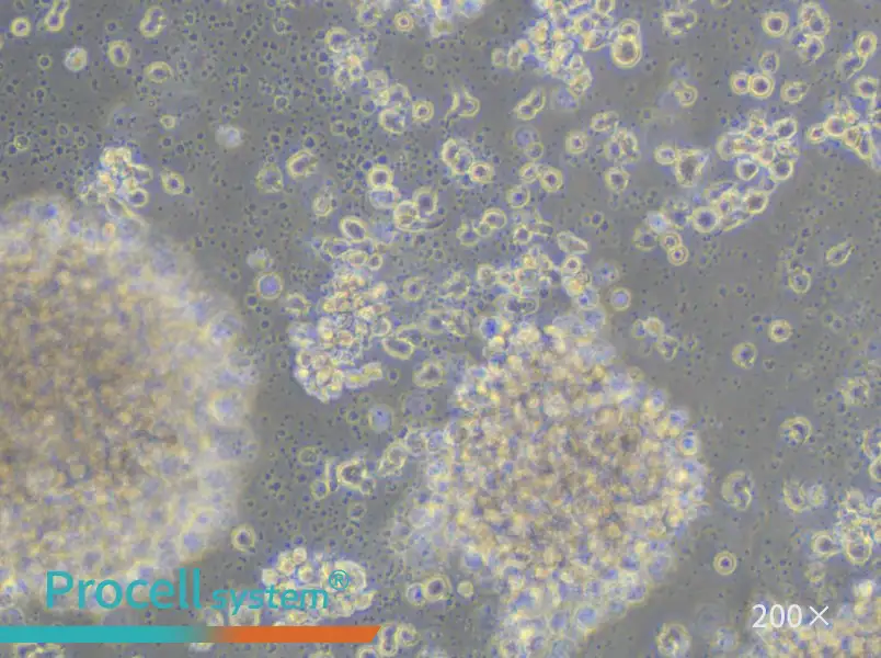 JVM-2 Cell Complete Medium - small - 5