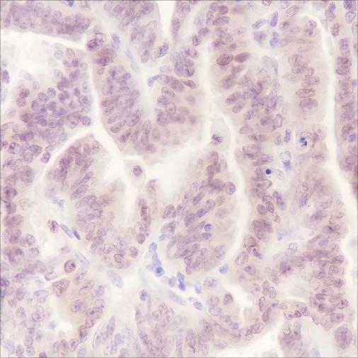 Recombinant Cdc27 Monoclonal Antibody - 3