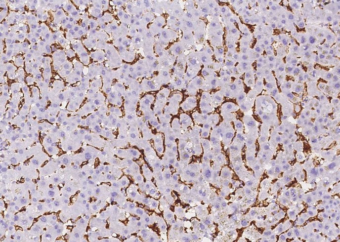 CD16b/FCGR3B Monoclonal Antibody-searchlist-1