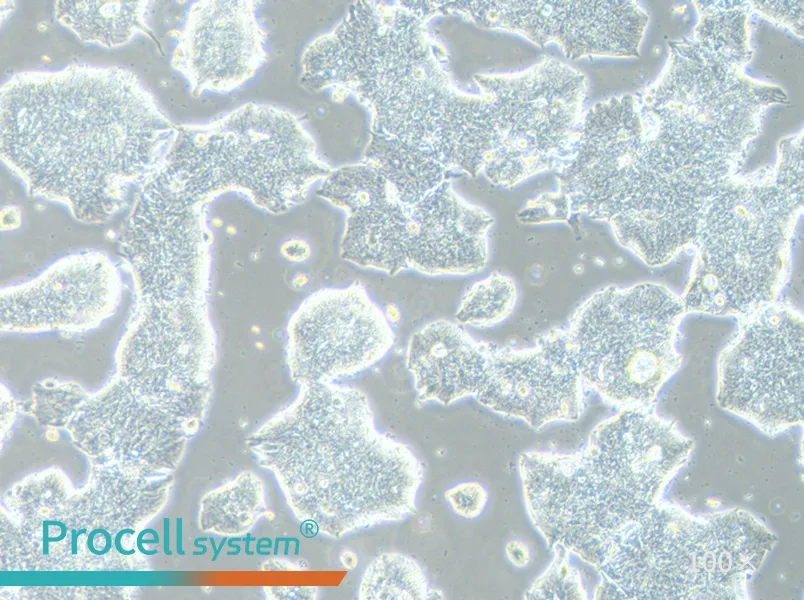 T84 Cell Complete Medium - 1