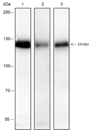 Recombinant EPHB4 Monoclonal Antibody-searchlist-1