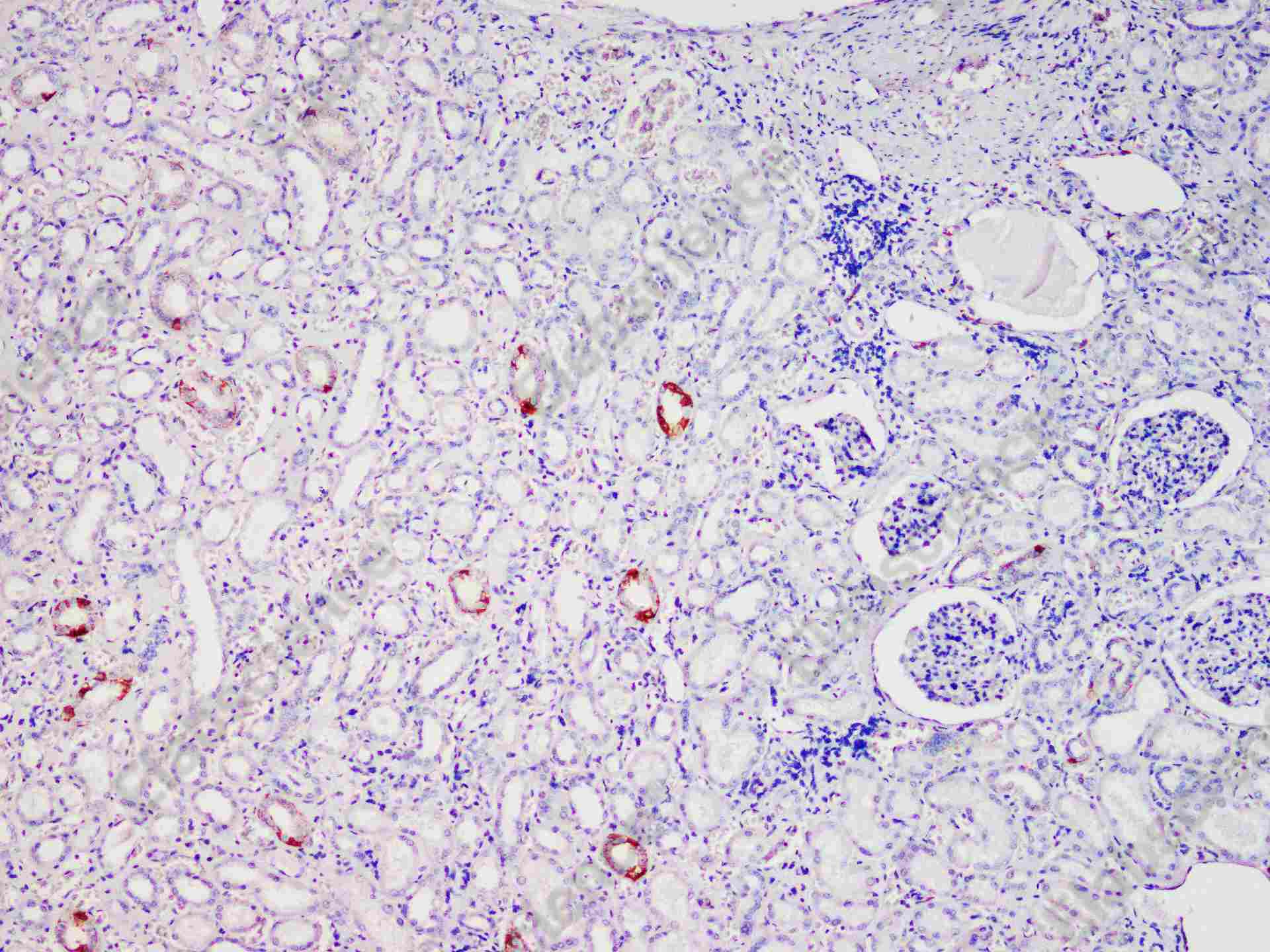 Recombinant CD171/N-CAML1/L1CAM Monoclonal Antibody - 1