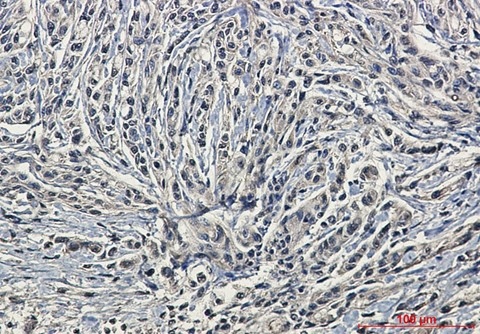 Recombinant Phospho-PKC alpha (Ser657) Monoclonal Antibody - 3