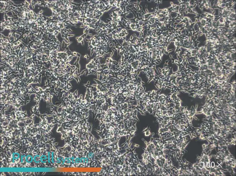 GP2d Cell Complete Medium - 1