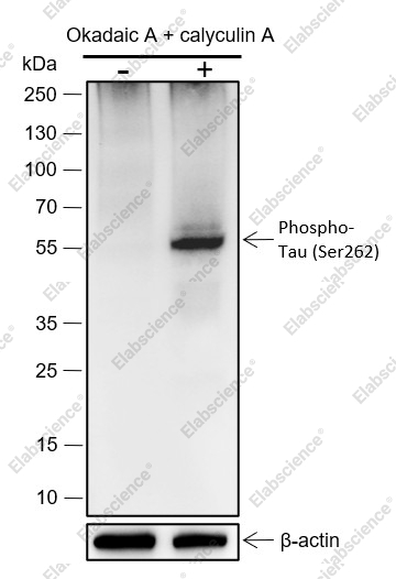 Recombinant Phospho-Tau (S262) Monoclonal Antibody - 1