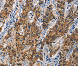 APOL1 Polyclonal Antibody - 2
