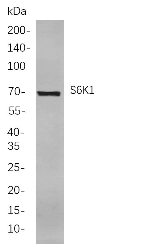 Recombinant S6K1 Monoclonal Antibody-searchlist-1
