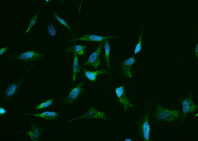 Clusterin/Apolipoprotein J/Apo-J/CLU Monoclonal Antibody - small - 2