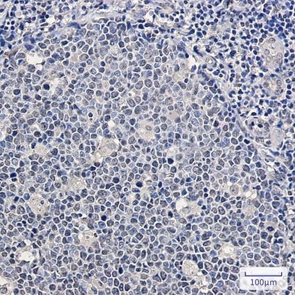Recombinant SF2 Monoclonal Antibody - 5