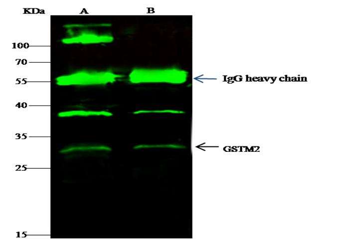 Recombinant GSTM2 Monoclonal Antibody