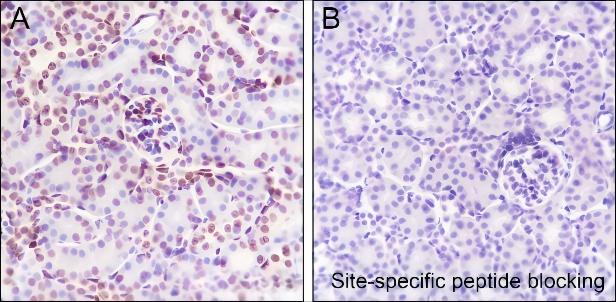 Recombinant Histone H3 (Acetyl Lys122) Monoclonal Antibody - small - 8