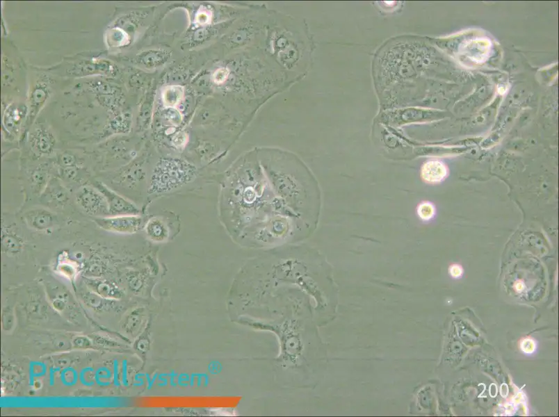 MKN-7 [MKN7; MKN 7] Cell Complete Medium - small - 6