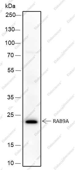 Recombinant Rab9A Monoclonal Antibody - 2