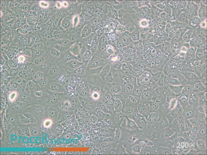 KYSE-30 Cell Complete Medium - small - 5