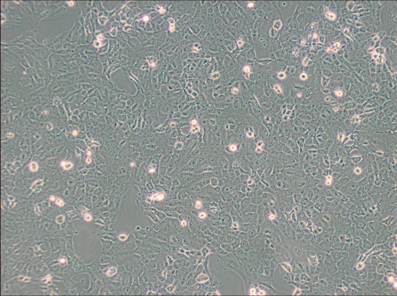 B-CPAP [BC-PAP; BCPAP] Cell Complete Medium - 2