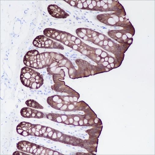 Recombinant Villin Monoclonal Antibody - 3