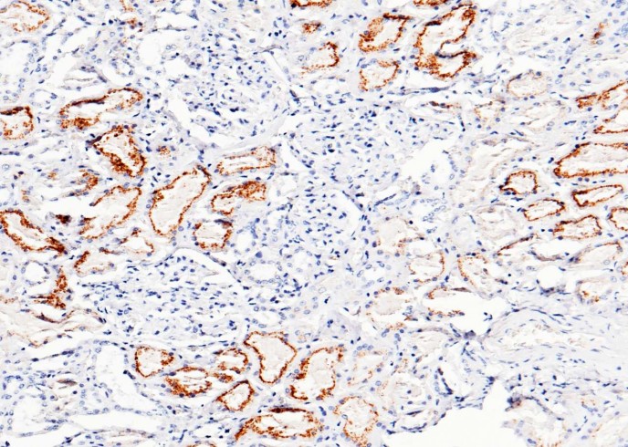 Recombinant Cystatin C/CST3 Monoclonal Antibody-searchlist-1