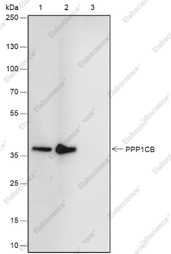 Recombinant PPP1CB Monoclonal Antibody - 6