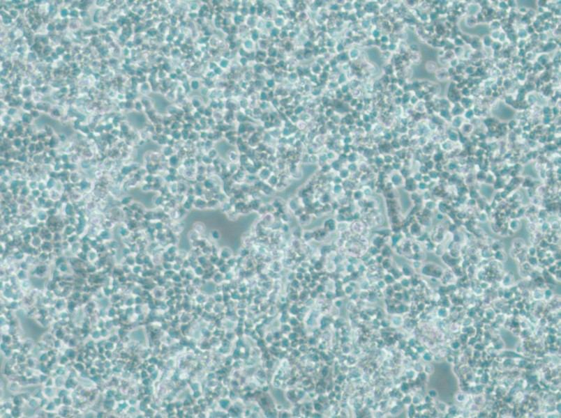 alpha TC1 clone 6 Cell Complete Mediumalpha TC1 clone 6 Cell Complete Medium - 3