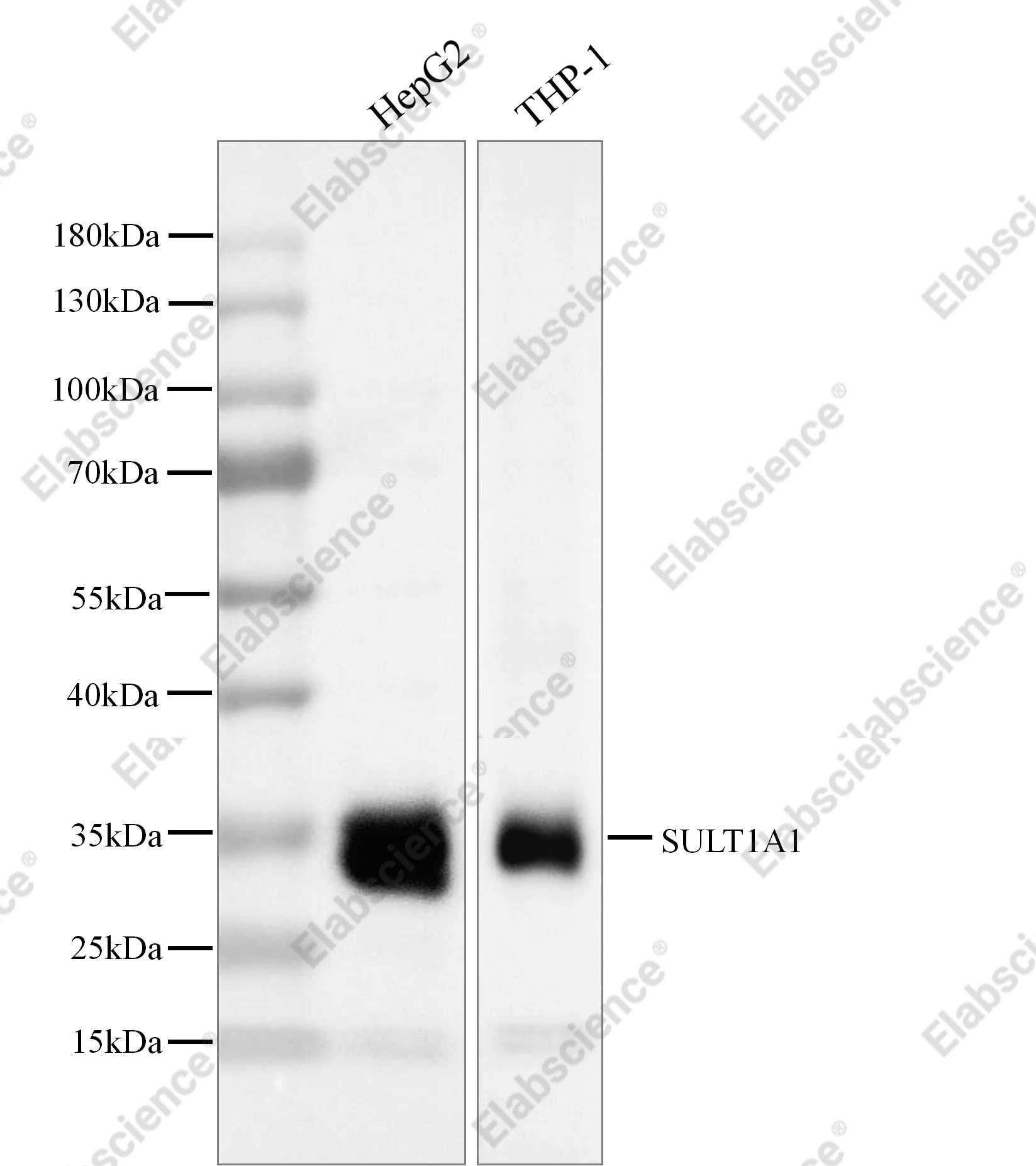 Recombinant SULT1A1 Monoclonal Antibody - 1