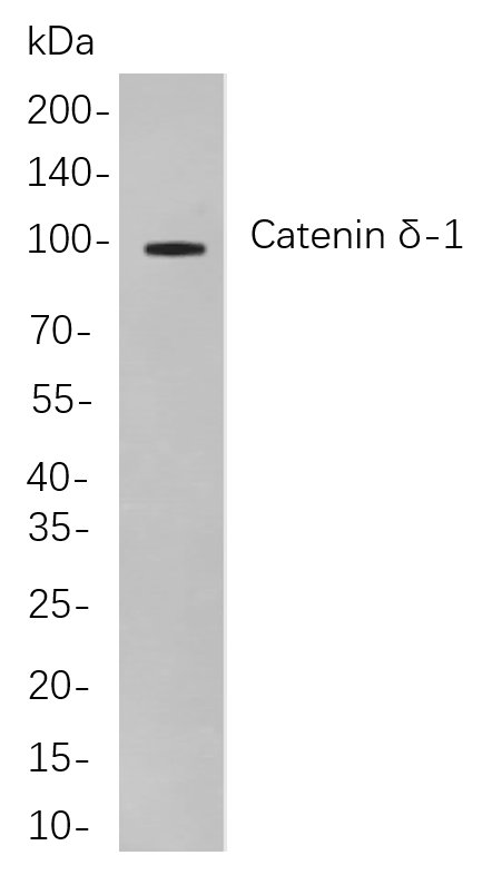 Recombinant Catenin δ-1 Monoclonal Antibody-searchlist-1