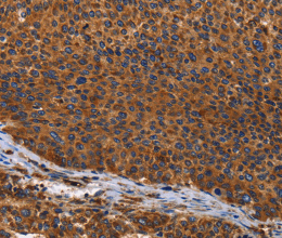 ILK Polyclonal Antibody - 2