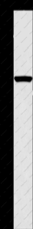 CPA2 Polyclonal Antibody - 1