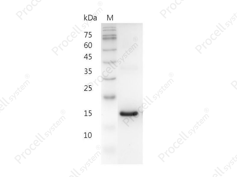 IFN&omega;/IFN alpha II-1/IFNW1, Human, Recombinant