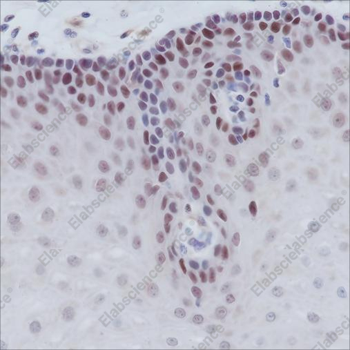 Recombinant MSH2 Monoclonal Antibody - 2