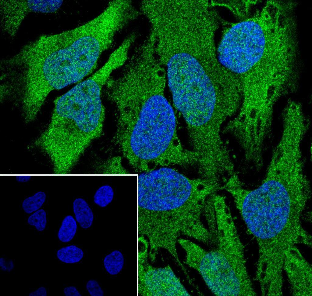 Recombinant CDK1/Cdc2 Monoclonal Antibody - small - 4