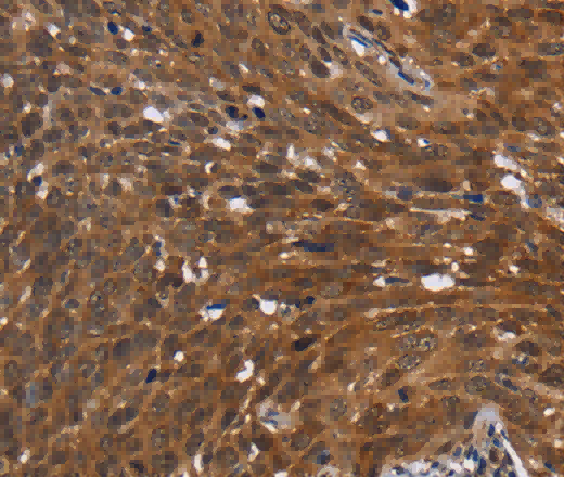 FHIT Polyclonal Antibody - 3