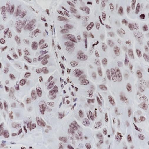 Recombinant ERCC1 Monoclonal Antibody - small - 4