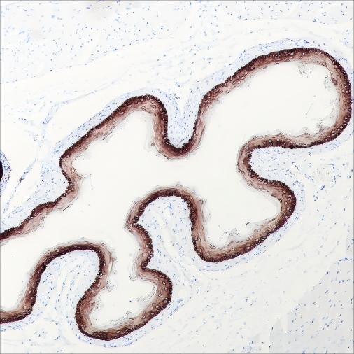 Recombinant Keratin 15 Monoclonal Antibody - small - 7