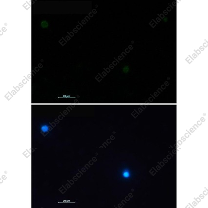 Recombinant CD79A/Ig-alpha Monoclonal Antibody - 3