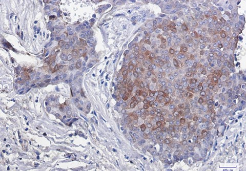 Recombinant Phospho-eIF4EBP1/eIF4EBP2/eIF4EBP3 (Thr45) Monoclonal Antibody - 2
