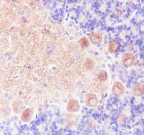 Recombinant GABA B Receptor 1 Monoclonal Antibody - 3