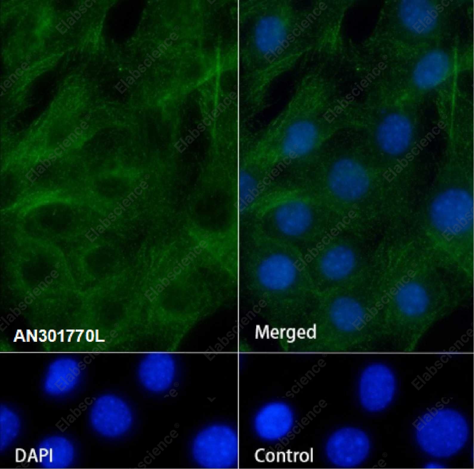 Recombinant ELP4 Monoclonal Antibody - 2