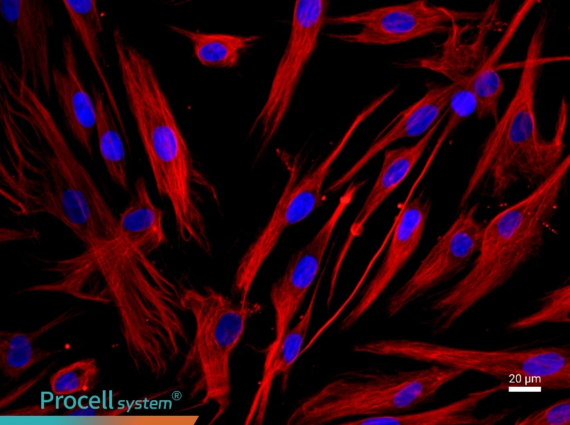 Human Bronchial Fibroblast Complete MediumHuman Bronchial Fibroblast Complete Medium - 2