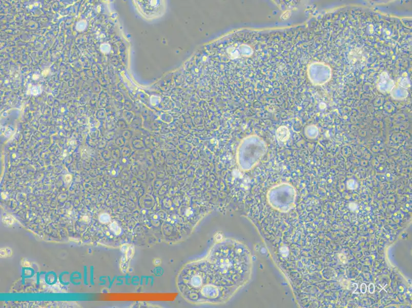 NCI-N87 [N87] Cell Complete Medium - small - 4