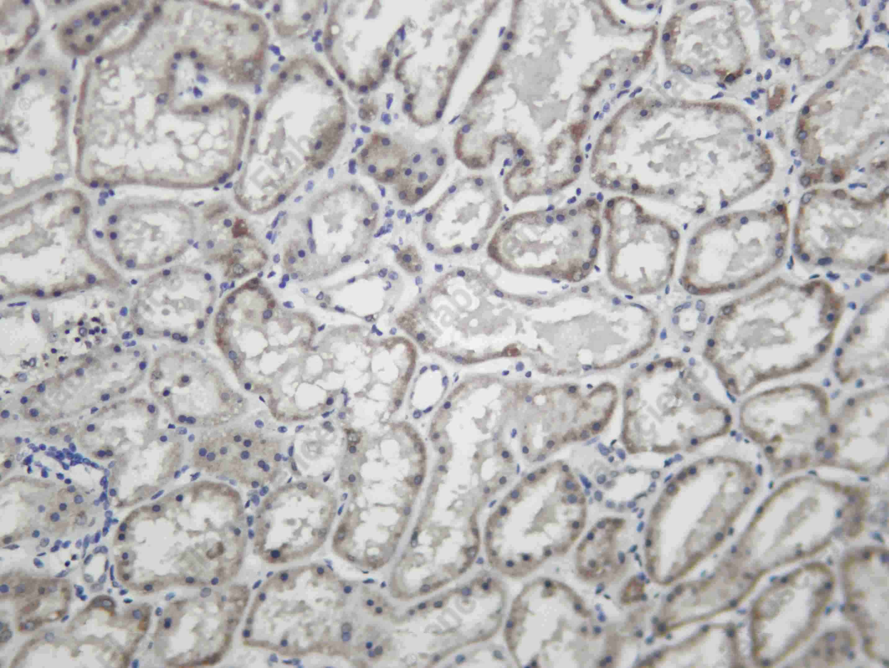 Recombinant SMUF2 Monoclonal Antibody - 1